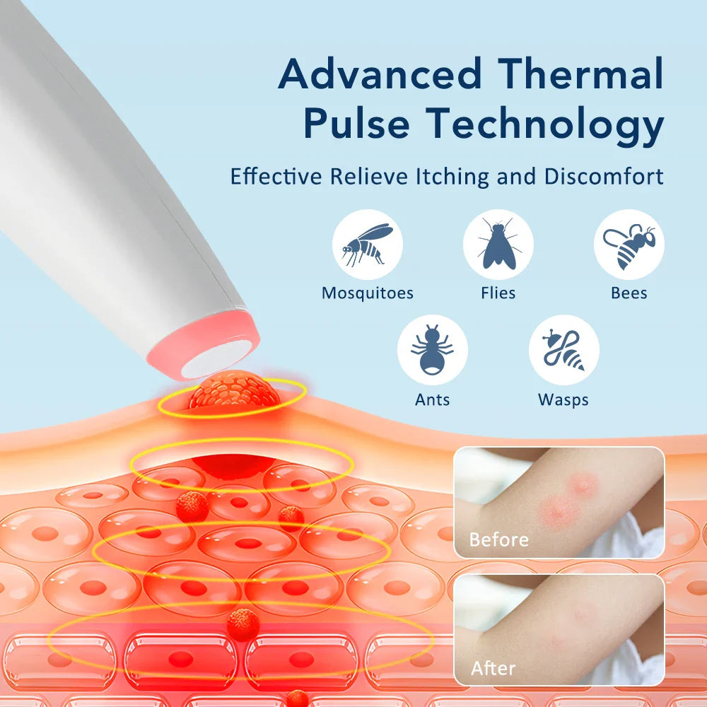 Soulageur Piqûres Insectes à Infrarouge Rechargeable - Anti-Démangeaison