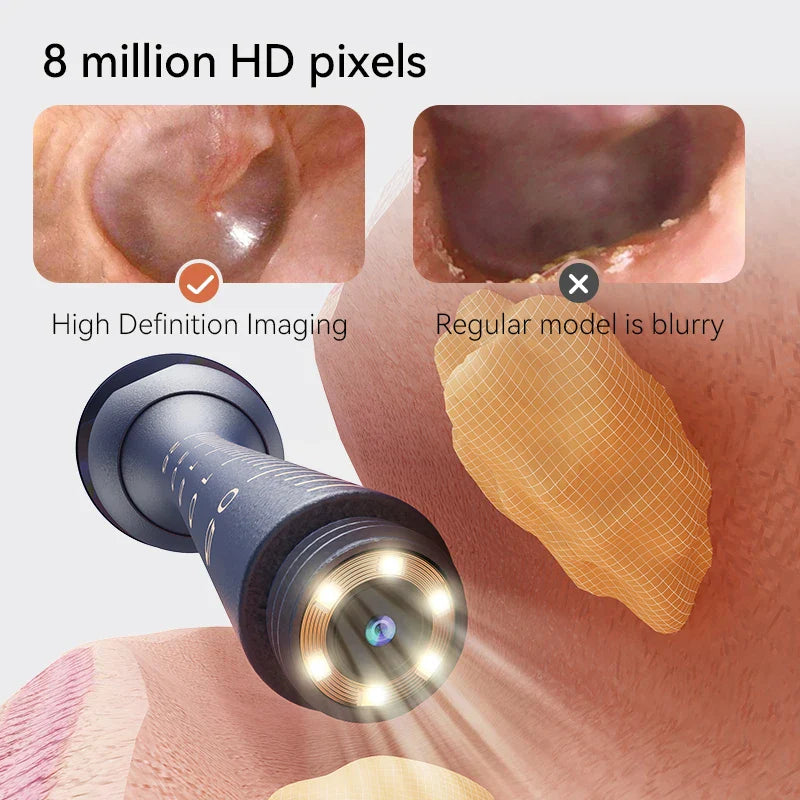 Nettoyeur 2 en 1 Oreilles & Nasal Connecté Intelligent
