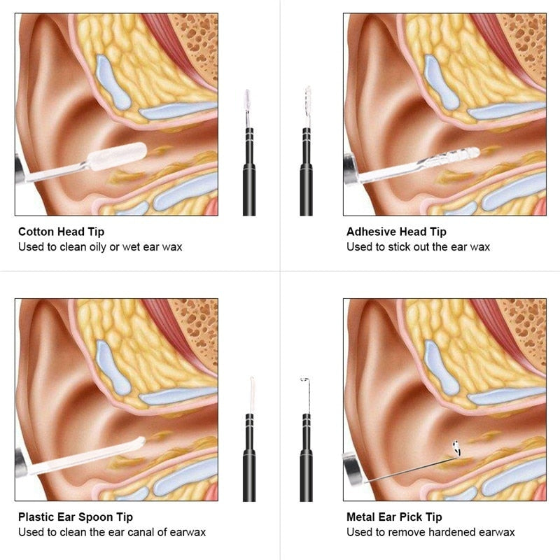 Caméra Otoscope HD - Micro USB, USB, USB Type-C